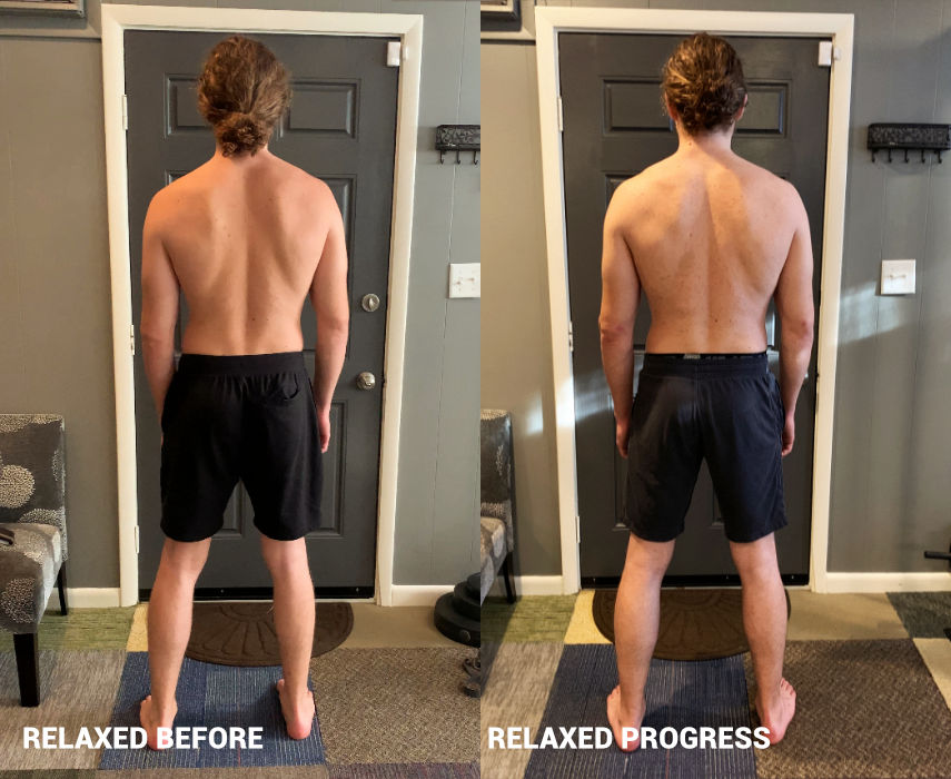 Scoliosis, athletic movement, muscle gain - Chattanooga, Nashville, Atlanta, Asheville, Birmingham, Cleveland, Knoxville