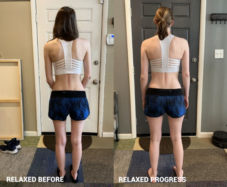 No muscle mass, lack of glutes, back pain, scapular winging -Chattanooga, Nashville, Atlanta, Fort Ogelthorpe, Cleveland, Knoxville